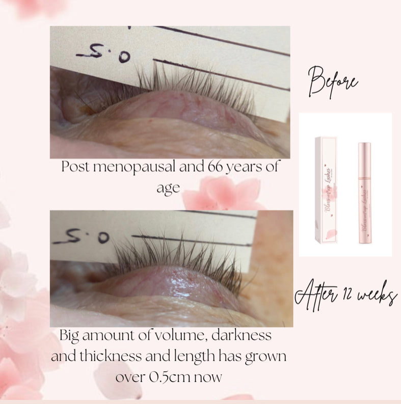 Blossom Up Lashes Growth Serum 5ml Vegan and Cruelty Free. Release “The Botanical Stimulants” to feed, invigorate, bloom!
